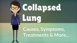 Collapsed Lung -  Causes, Symptoms, Treatments & More…