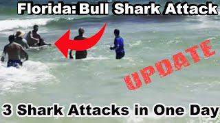 Update: 3 Florida Shark Attacks in 1 Day Teen Loses Arm & Leg to Shark Lulu Gribbin,Elisabeth Foley