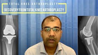 Recovery after Total knee replacement - Orthopaedics - Detailed Discussion