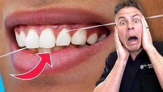 Don't Try And Use This Flossing LIE With Your Dentist!