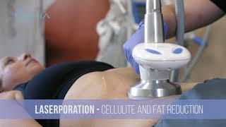 Body Sculpting, Cellulite Treatment by Eximia, Immediate Results | Aesthetics Medical Spa NJ