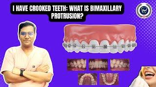 Dr Rudra Mohan | I Have Crooked Teeth: What is Bimaxillary Protrusion? Understand Treatment Options