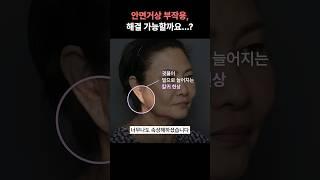 안면거상 부작용 왜 발생할까? 실제 사례 공유드립니다.   #안면거상부작용 #안면거상술잘하는병원 #안면거상술
