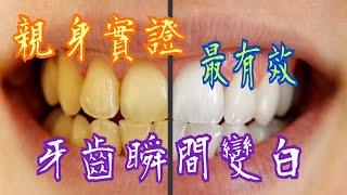 牙齒發黃不用花錢洗牙瞬間變白有效簡單更能排毒The fastest way to whiten your teeth