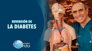 REVERSIÓN DE LA DIABETES - HACIA UN NUEVO ESTILO DE VIDA