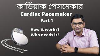 কার্ডিয়াক পেসমেকার. Cardiac Pacemaker Part 1 Dr Arindam Pande.  Who needs it? How it works? Dr A P.