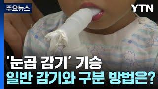 기승하는 '눈곱 감기'... 일반 감기와 구분하는 방법은? [Y녹취록] / YTN