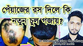 পেঁয়াজের রস কি চুল গজায়? does onion juice grow hair? ঘরোয়া টোটকা।Dr mahamudul islam chowdhury