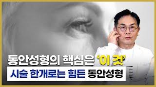 동안성형의 핵심은 '이 것' 당긴다고 젊어지는 게 아닙니다!