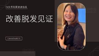 美商凯丽环球产品NMN和PQQ氢气片改善脱发见证#凯丽环球 #美商凯丽 #头号玩家 #caleriehealth