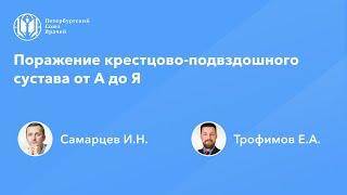 Поражение крестцово-подвздошного сустава от А до Я