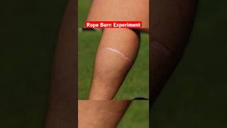 Insanely Painful ROPE BURN Experiment… #funny #science #comedy