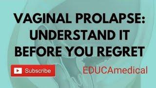 Vaginal Prolapse: Various Causes of Vaginal prolapse