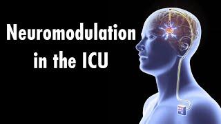 Neuromodulation in the intensive care unit