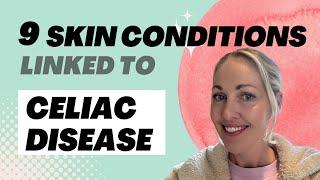 9 Skin Conditions Linked to Celiac Disease