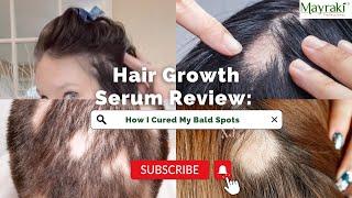 Hair Growth Serum | Hairfall control | - Mayraki Review Before & After: Transformative Results