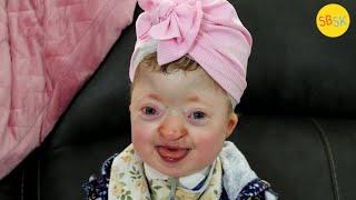 Josie's Joyful Life (One Of the World's Rarest Syndromes)