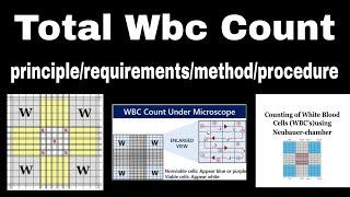 TLC | total leukocytes count | wbc count | in hindi | ph patho hub | manual method | #dmlt #bmlt #