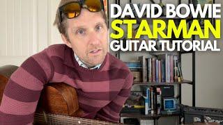 Starman by David Bowie Guitar Tutorial - Guitar Lessons with Stuart!