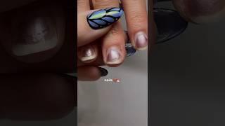 this nail transformation ‍  #nails #nailsathome #beforeandafter #transformation #nailart