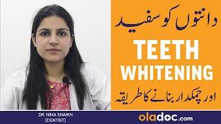 TEETH WHITENING IN URDU - Danto Ko Safaid Karne Ka Tarika - Dental Bleaching Treatment & Procedure