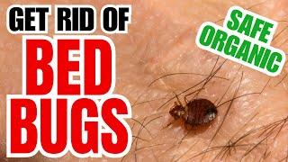 How To Get Rid Of Bed Bugs | 10 Safe Organic And Natural Methods