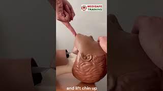 How to open a child airway