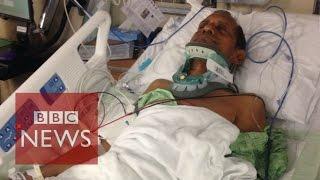 Indian injured by US police speaks out - BBC News