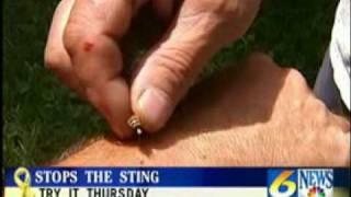 www.stingsandbites.com presents Stops the Sting challenge WJACTV