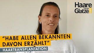 Warum Haartransplantation als Frau? Eine Patientin berichtet.