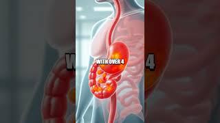 Early Signs of Peptic Ulcer Disease