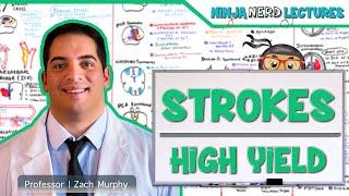 Ischemic and Hemorrhagic Strokes | High Yield