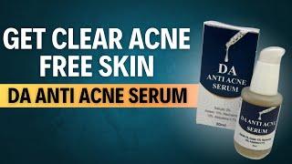 Best Anti-Acne Serum for pimples | Powerful Ingredients for Clearer Skin