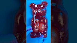 Worlds Biggest Gummy Bear Gives Birth! 36 Babies in Satisfying c-Section #DiscountDentist