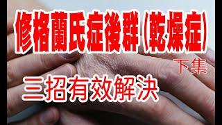 自體免疫疾病系列(三) 修格蘭氏症(乾燥症) 下集