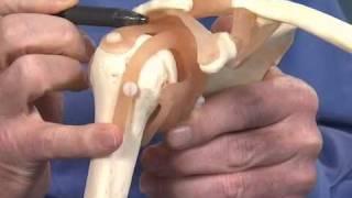 Shoulder Impingement - Dr. Richard Hawkins