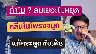 ลมเยอะไม่หยุดสักที | กลิ่นแรงในโพรงจมูก | กระดูกทับเส้น - หมอนัท ตอบคำถาม