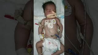 NICU baby face's clean #motivation #video #virals #nursing work #gnm