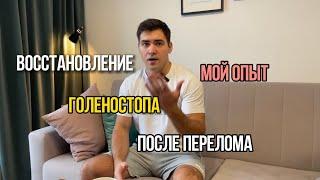 Восстановление голеностопа после перелома таранной кости. Мой опыт.