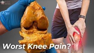 How Arthritis Destroys Your Knees