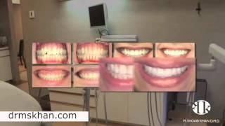 Alex Talks About Cosmetic Procedures At Dr. S Khan's Dental Practice