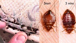 BED BUG BITES SYMPTOMS, TREATMENT, PREVENTION