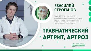 Травматический артрит и артроз: причины, симптомы и лечение | Василий Строганов