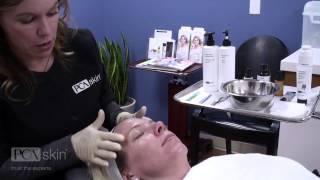 Dermaplaning & PCA SKIN Professional Treatments