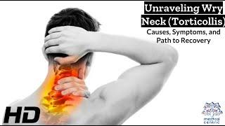 Wry Neck Torticollis: The Silent Struggle and How to Overcome It