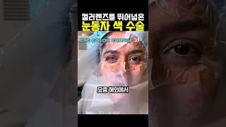 컬러렌즈를 뛰어넘은 눈동자 색 수술