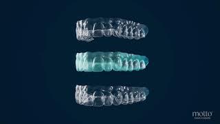 Meet Motto’s Next-Gen Clear Aligners