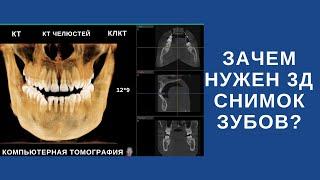 Что такое 3д снимок зубов и зачем он нужен?