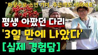 평생 아팠던 다리 '3일 만에 나았다' [실제 경험담]