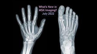 Musculoskeletal (MSK) Imaging Updates - July 2022